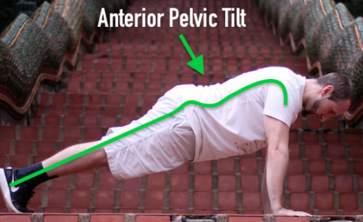 Anterior Pelvic Tilt during Pushups